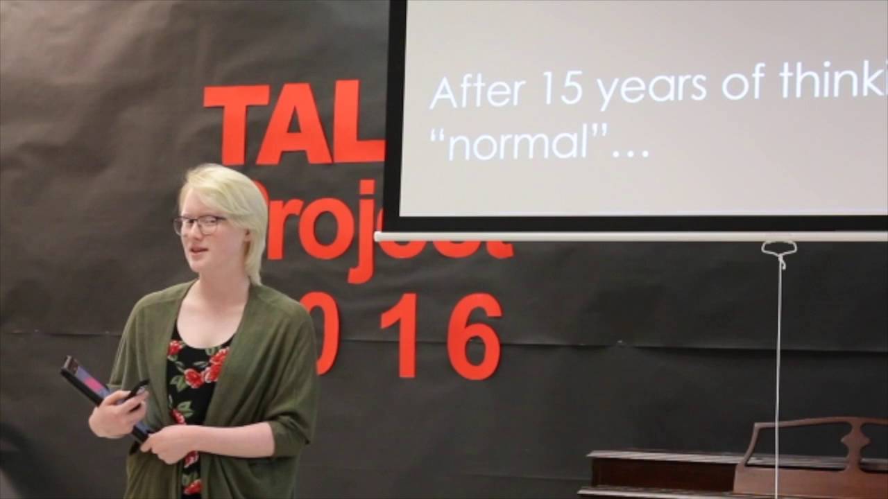 Bryce Talks About Life With Albinism