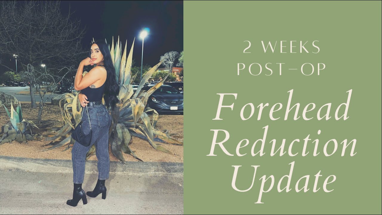 FOREHEAD REDUCTION//2 WEEK POST-OP UPDATE