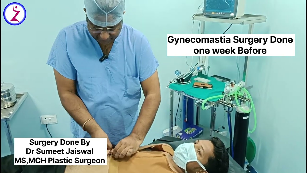 Gynecomastia Surgery Day 7 After Surgery . Delhi Mumbai Bangalore Chandigarh kolkata Indore Surat