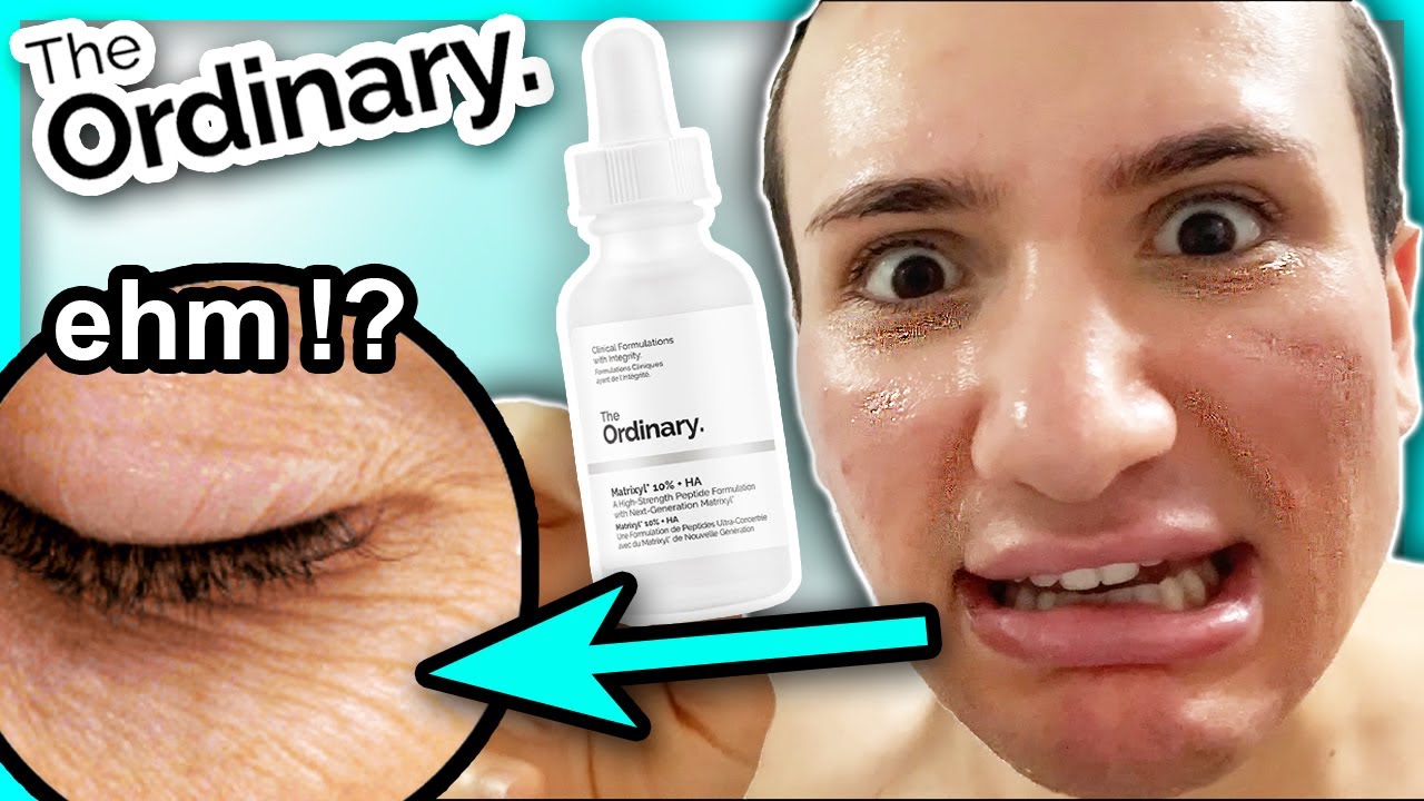 I tried the ordinary MATRIXYL 10% + HA for TWO WEEKS!