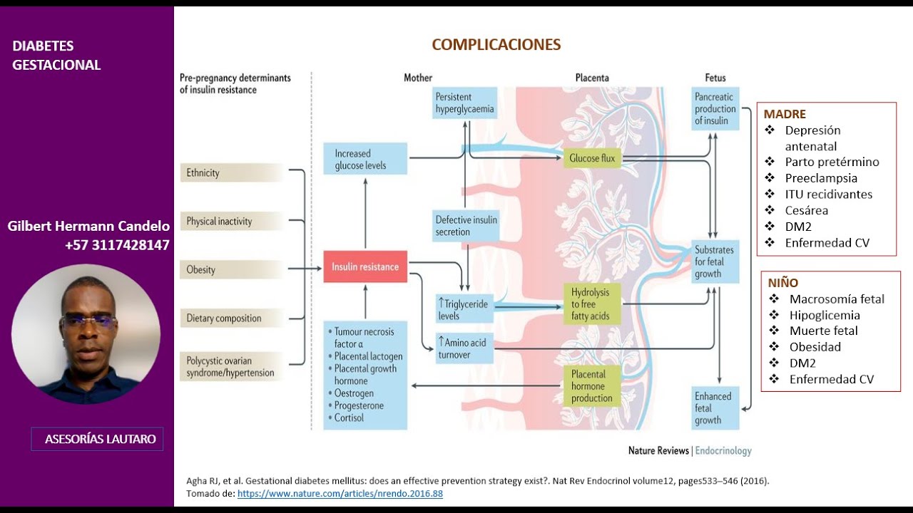 Diabetes Gestacional: Definición, fisiopatología, complicaciones, diagnóstico, tratamiento.