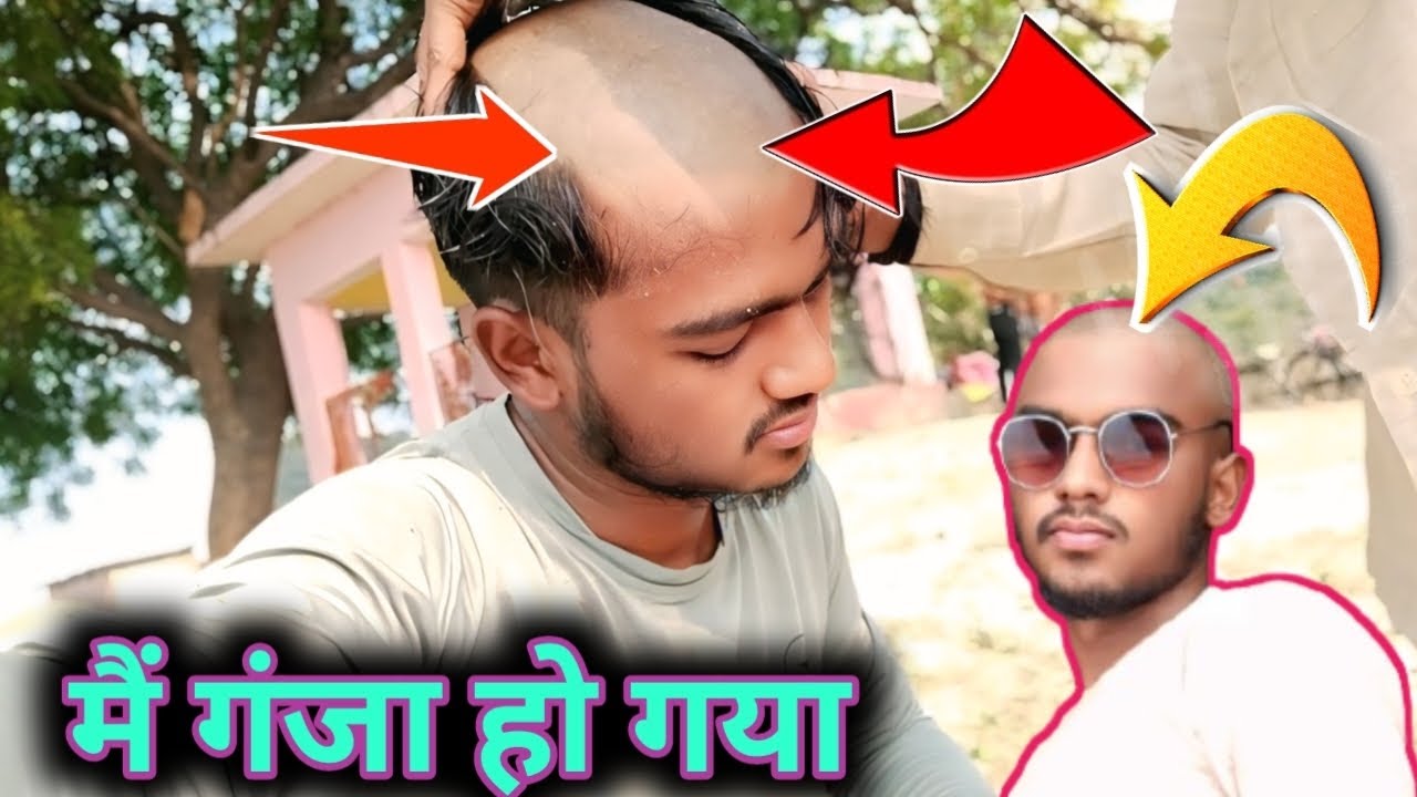मैं गंजा हो गया ll why ll लास्ट तक वीडियो देखे ll #ganja #takla #katapa#viralvideo #trending video 