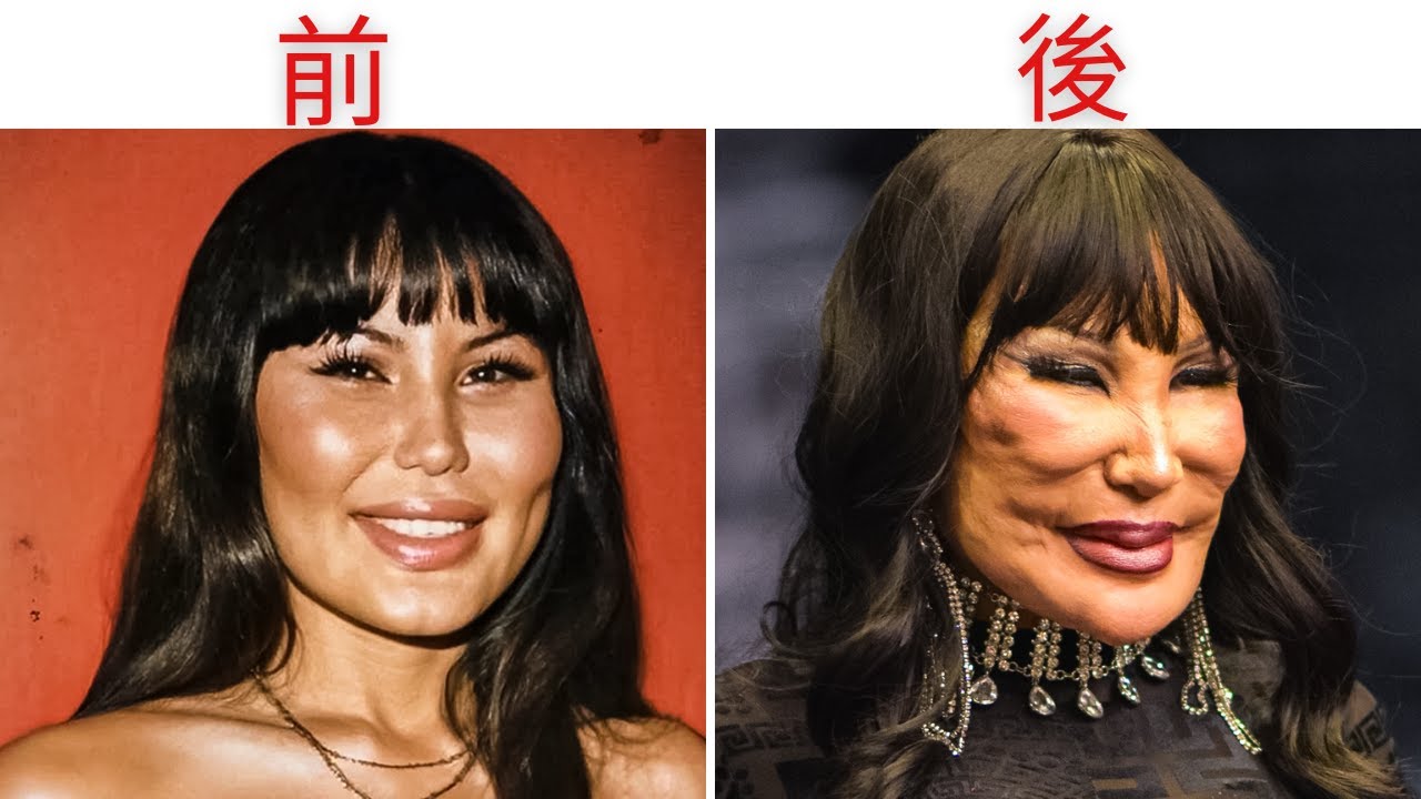 写真で比較する セレブ40人の整形ビフォー・アフター