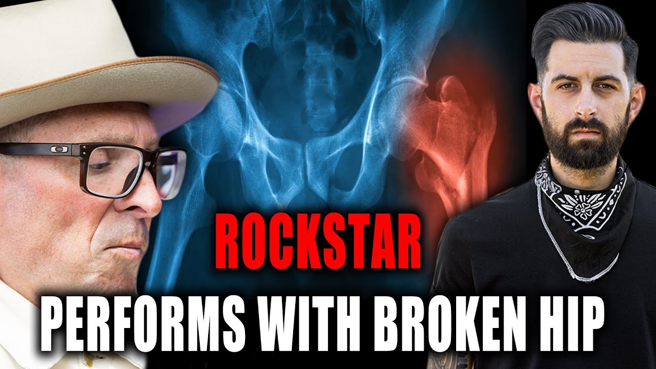 Performing with a Broken Hip! Mike Dimkich