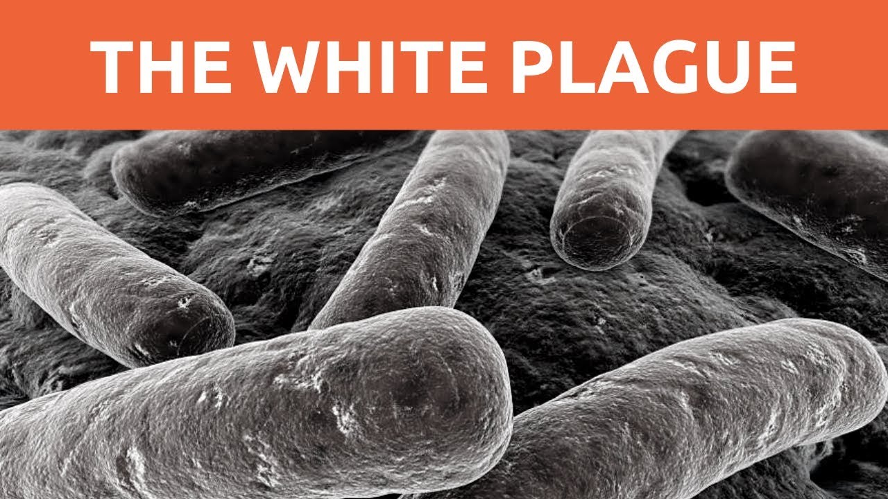Nobel Prizes Explained: The Cause of the White Plague