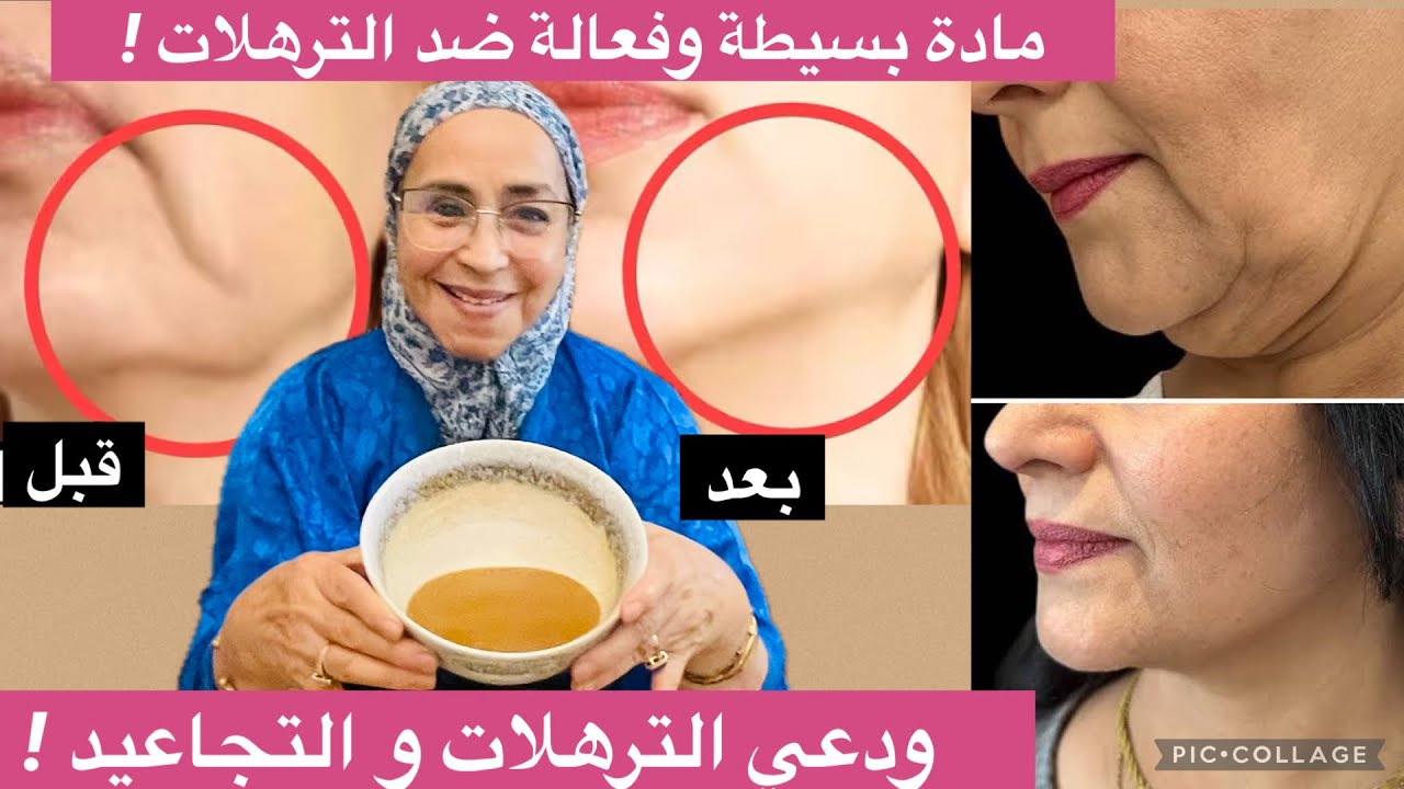 سر مغربي قوي لشدّ البشرة والتخلص من التجاعيد طبيعياً.. بعد أيام لن تصدّقي النتيجة!