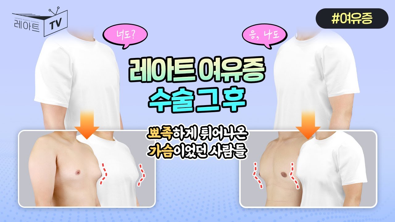 [여유증수술] 전후로 달라지는 갑빠모습 [레아트성형외과]