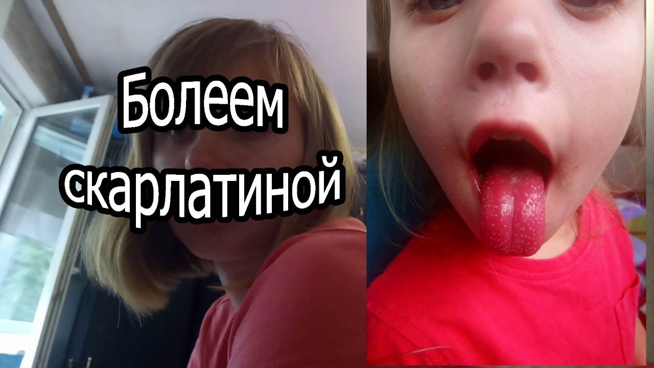 Мои подозрения на скарлатину / Доктор подтвердил / Болеем