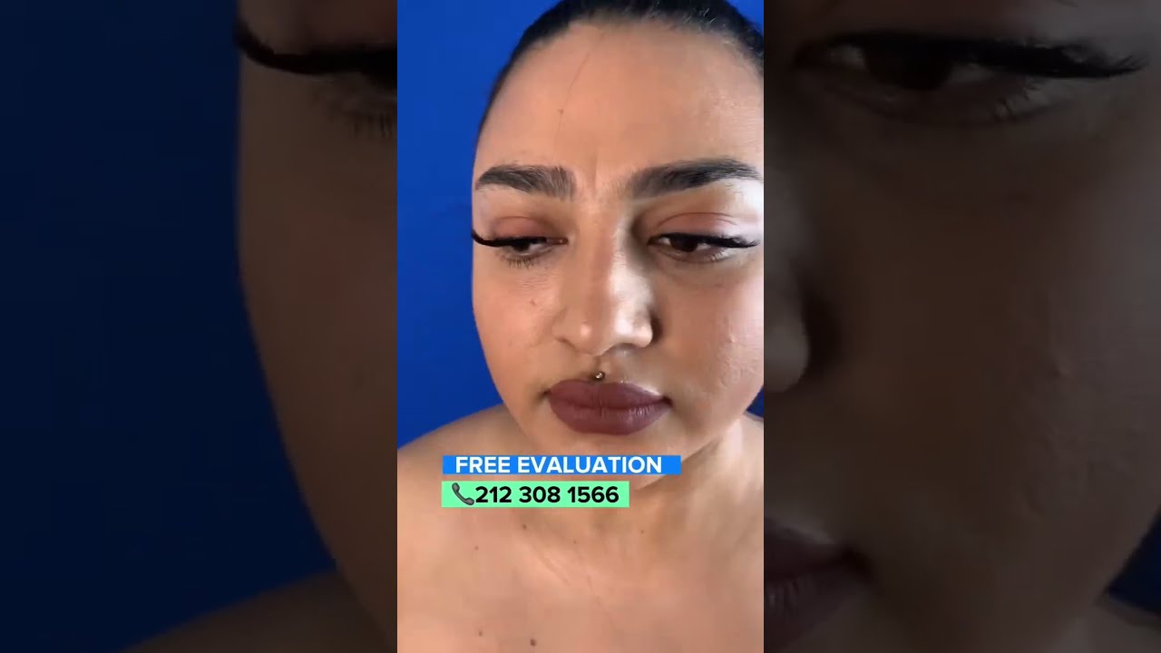 ✅Facial Sculpting & Rejuvenation