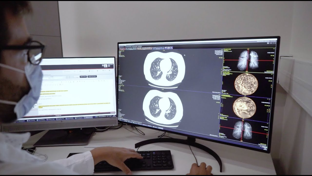 Diagnóstico do cancro: o papel da imagem (Medicina Nuclear e Radiologia) | CUF