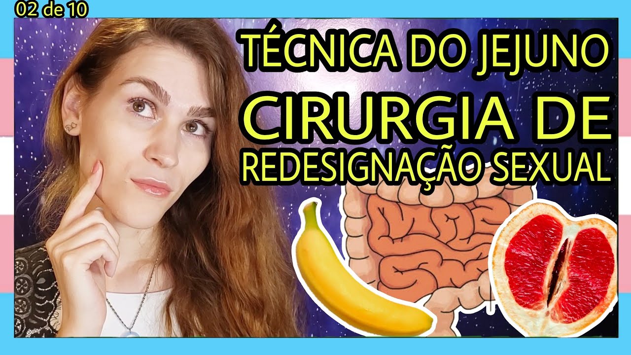 [284] Técnica do Jejuno; como é feita a cirurgia de redesignação sexual do Dr. Marcio Littleton