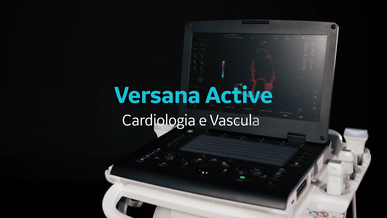 GE Versana Active: Cardiologia e Vascular | GE do Brasil