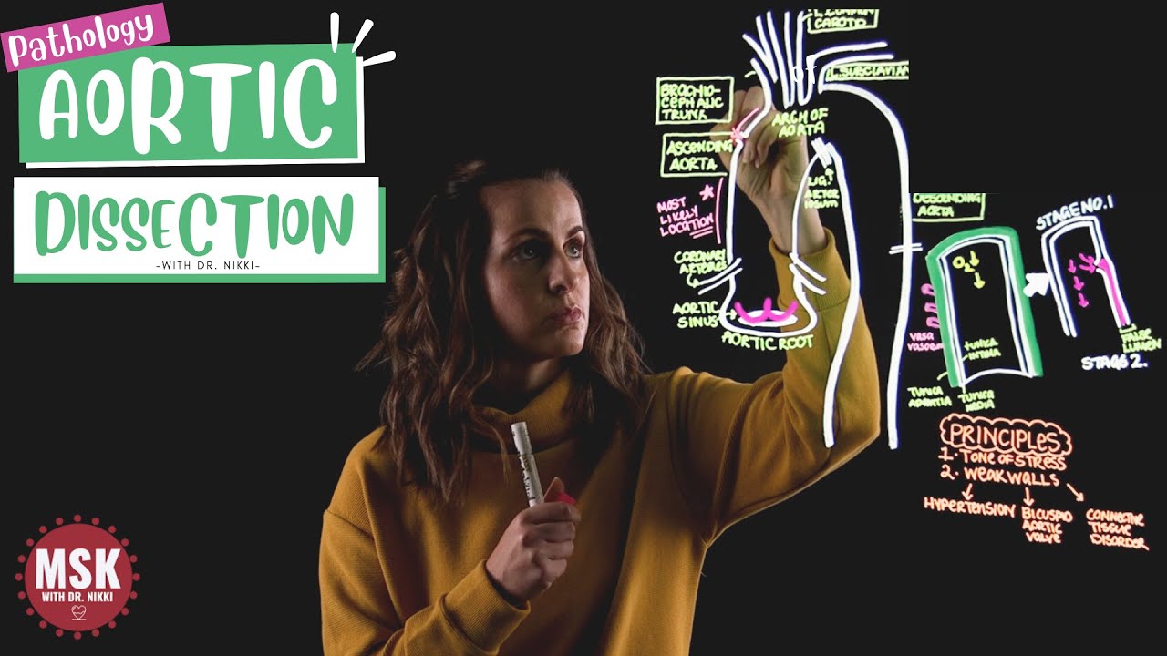 Applied Anatomy of Aortic Dissection