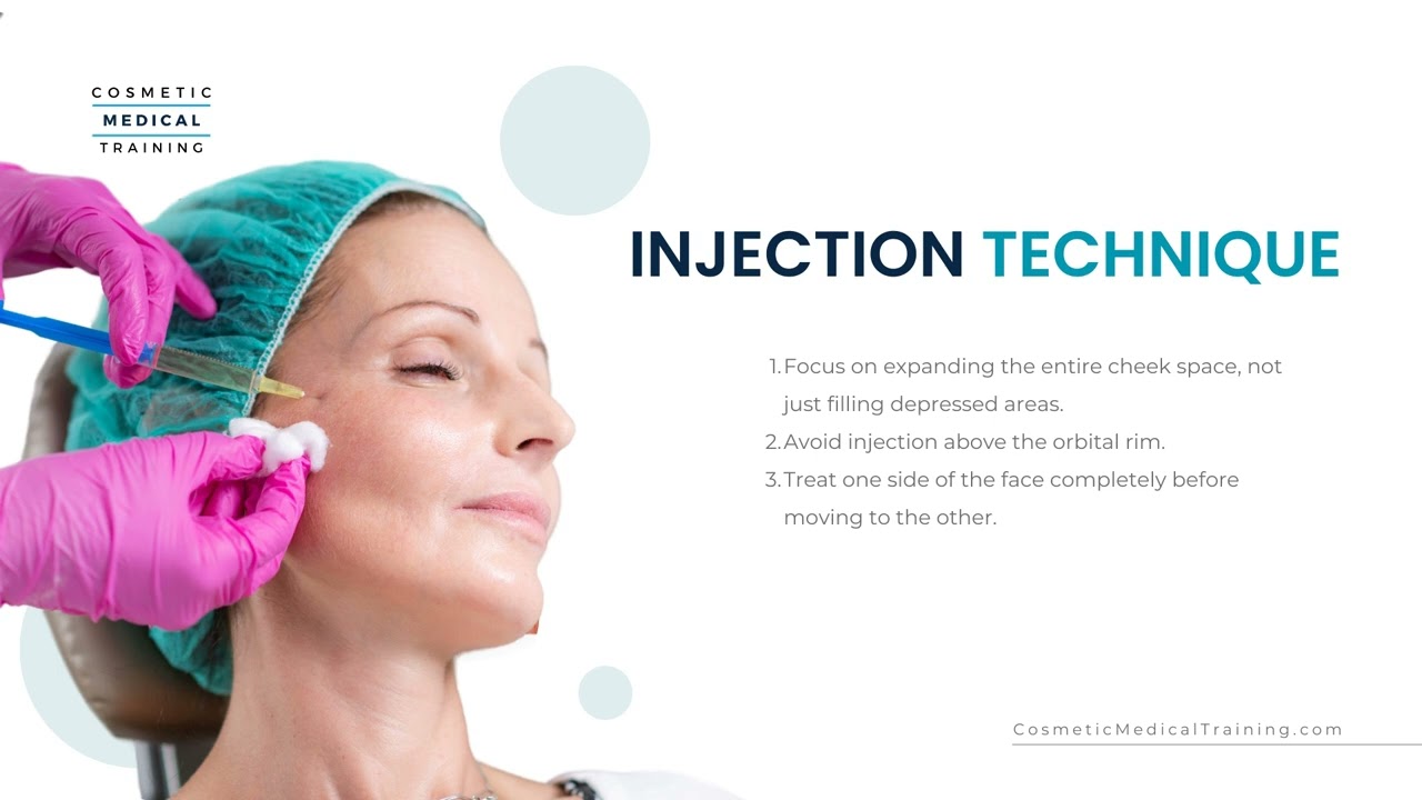 Radiesse Injection Training: Mastering the Cheek Technique