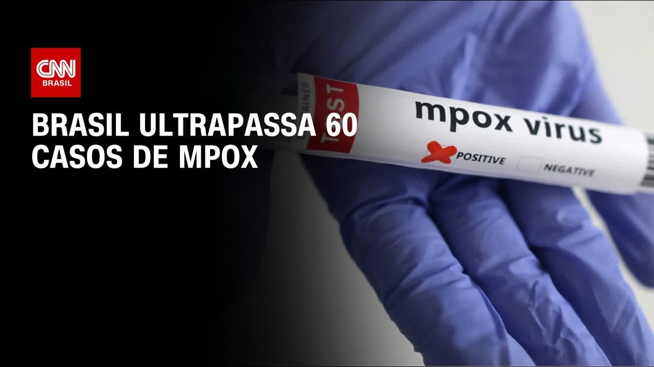 Mpox: Brasil registra mais de 60 casos da doença | CNN NOVO DIA