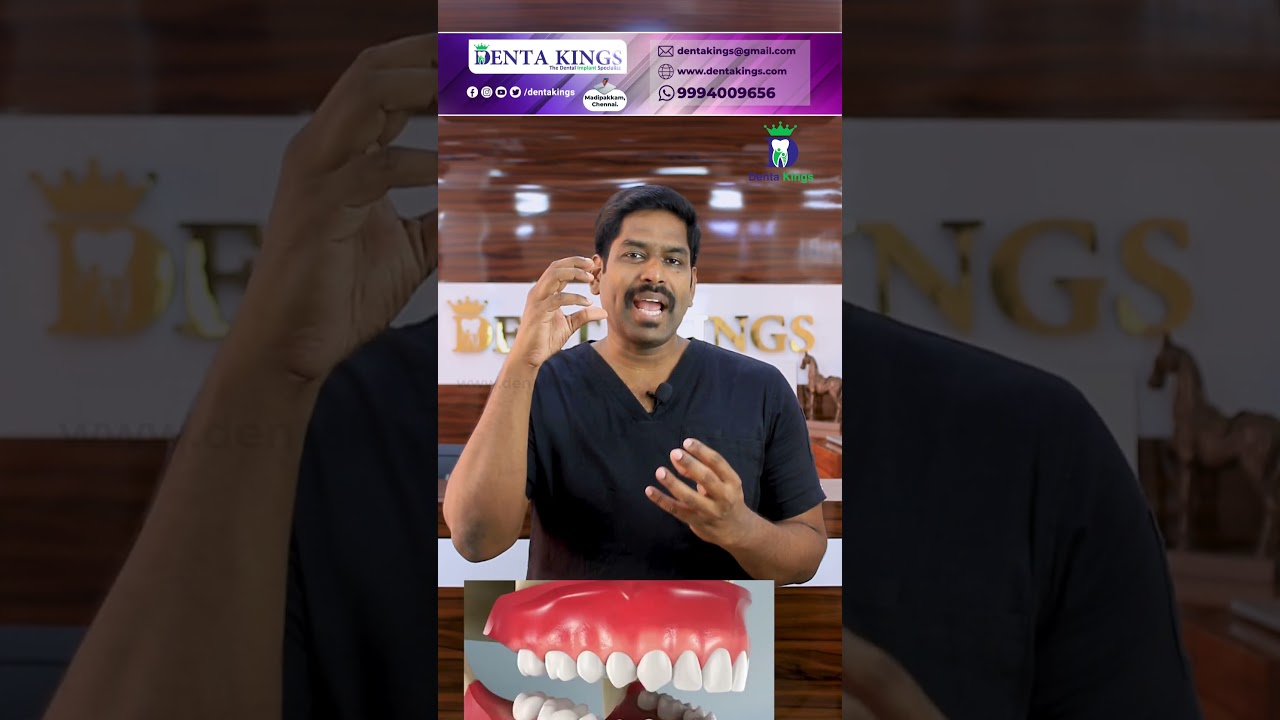 பல் சொத்தை ஒரு பல்லில் இருந்து எல்லாப் பல்லுக்கும் பரவுமா? Spreading tooth decay Dr.Karthikeyan