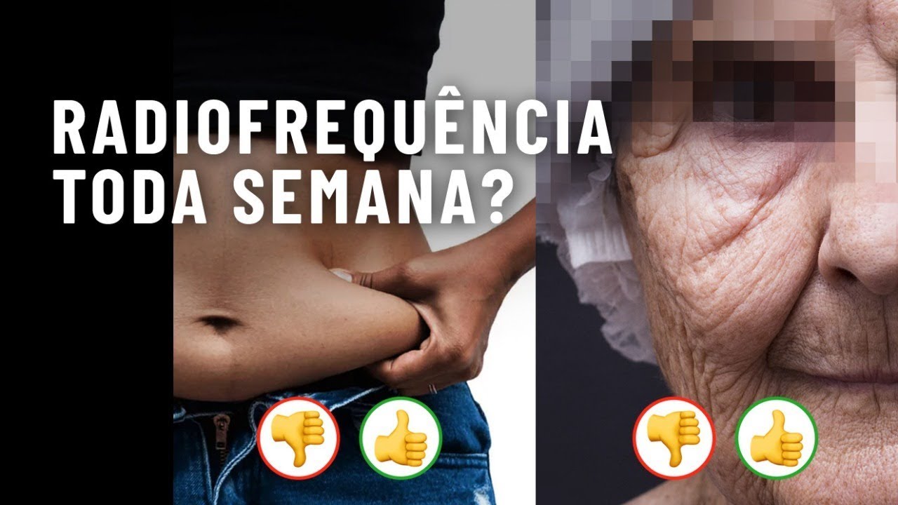 Posso aplicar RADIOFREQU&Ecirc;NCIA toda semana?