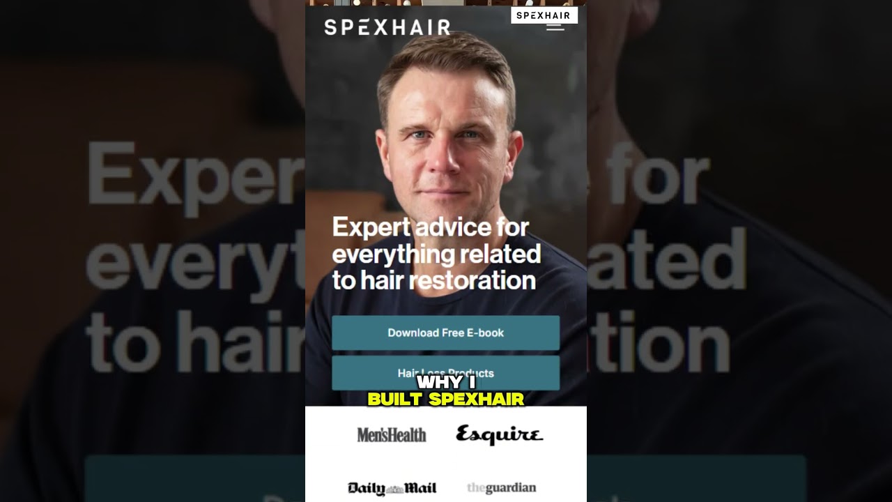 Thinking of getting a hair transplant ? 