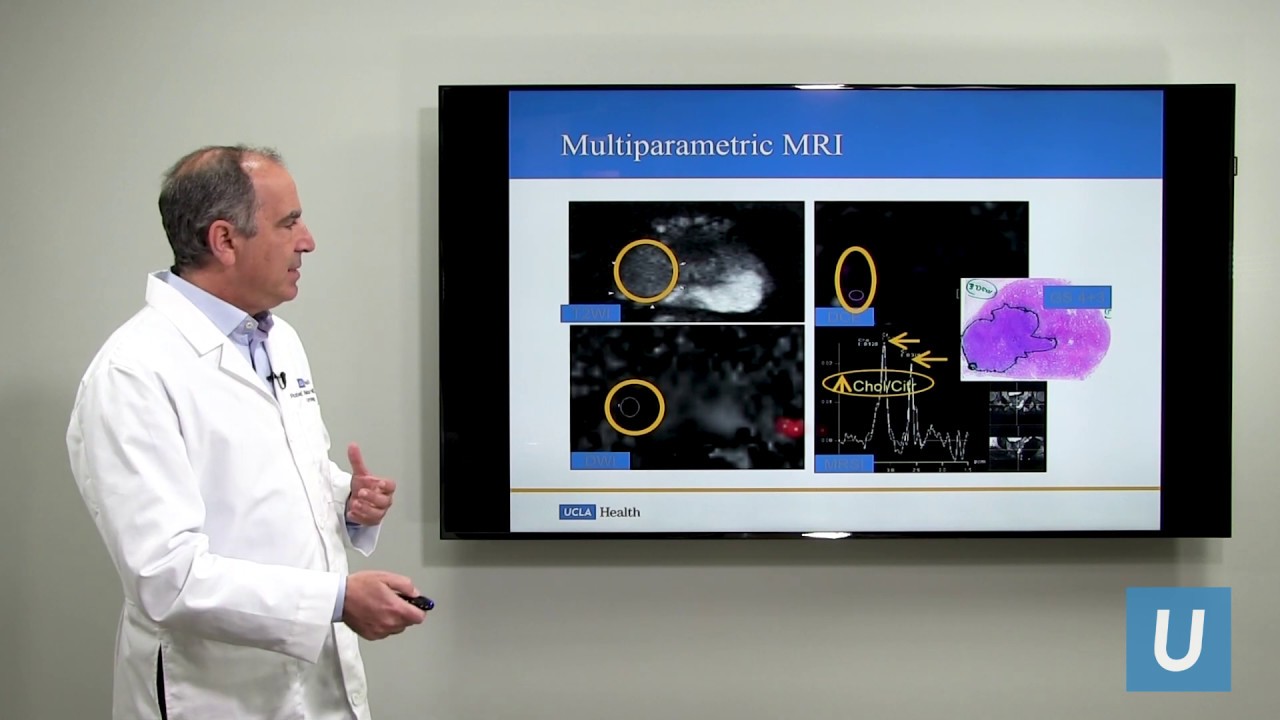 Integrating Imaging & Genomics in the Management of Prostate Cancer - Robert Reiter, MD | UCLAMDChat