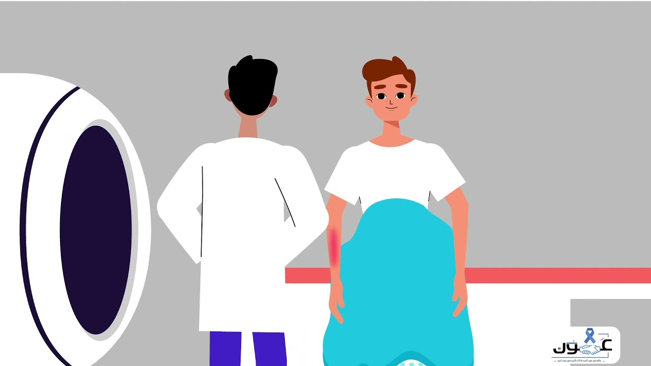 العلاج الاشعاعي لأورام البروستاتا