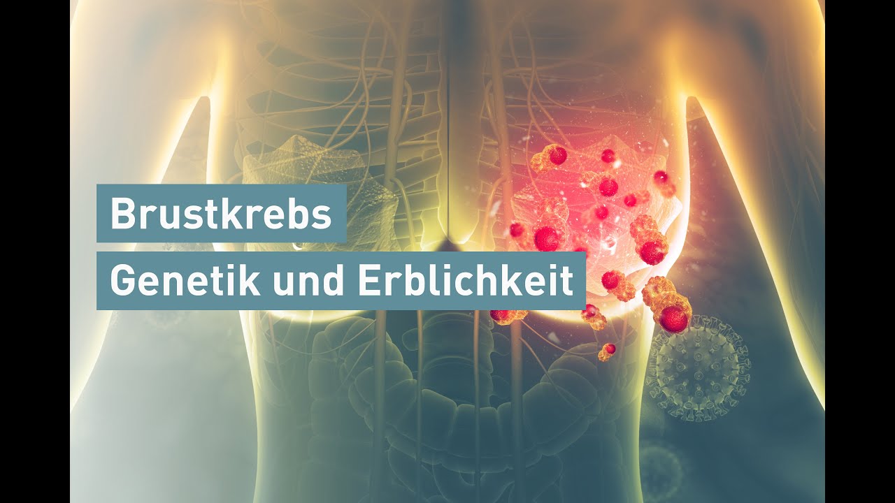 Brustkrebs: Genetik und Erblichkeit