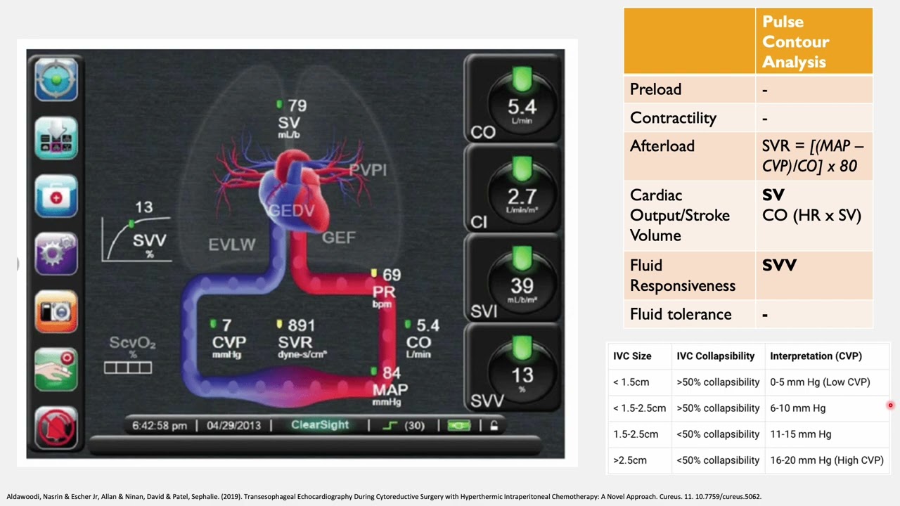 Cardiac Output Monitoring