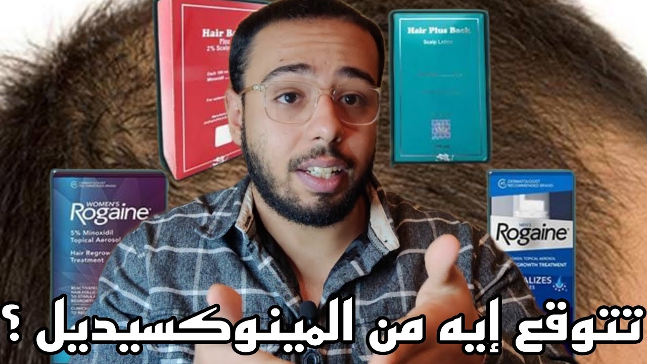 تتوقع نتيجة إيه من المينوكسيديل ؟ وهل ينفع تستخدمه لوحده لعلاج الصلع الوراثي ؟