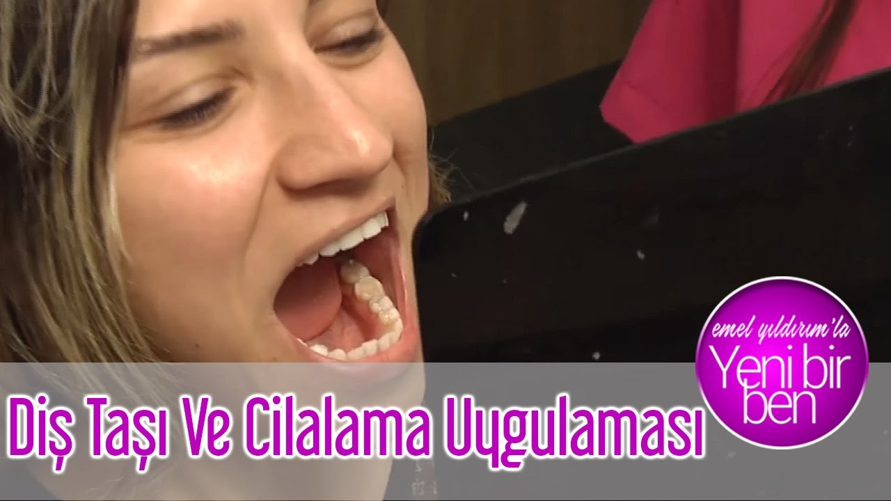 Diş Taşı Ve Cilalama Uygulaması - Emel Yıldırım'la Yeni Bir Ben