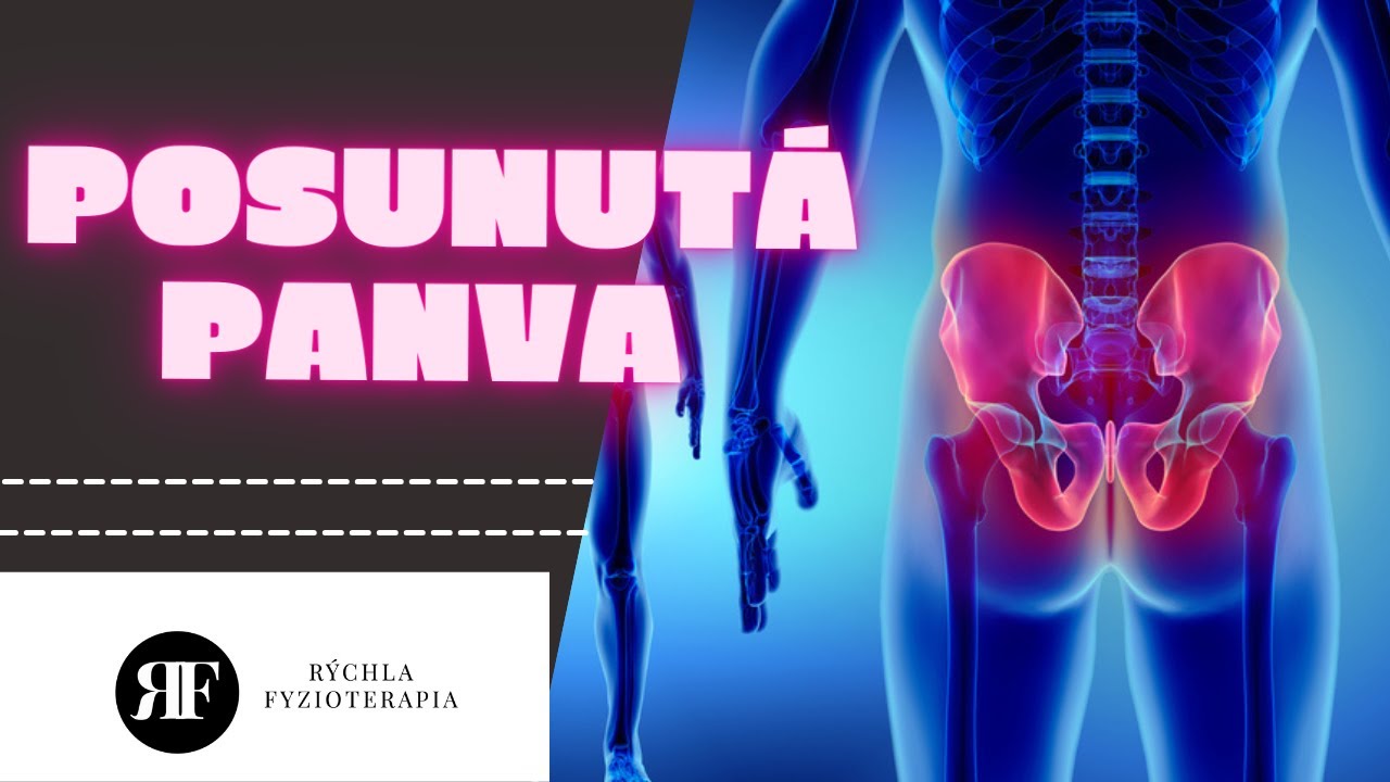 🏄🏼‍♂️  Posunutá panva, šikmá panva. ☝🏻 Cviky a ako nato? Rýchla Fyzioterapia