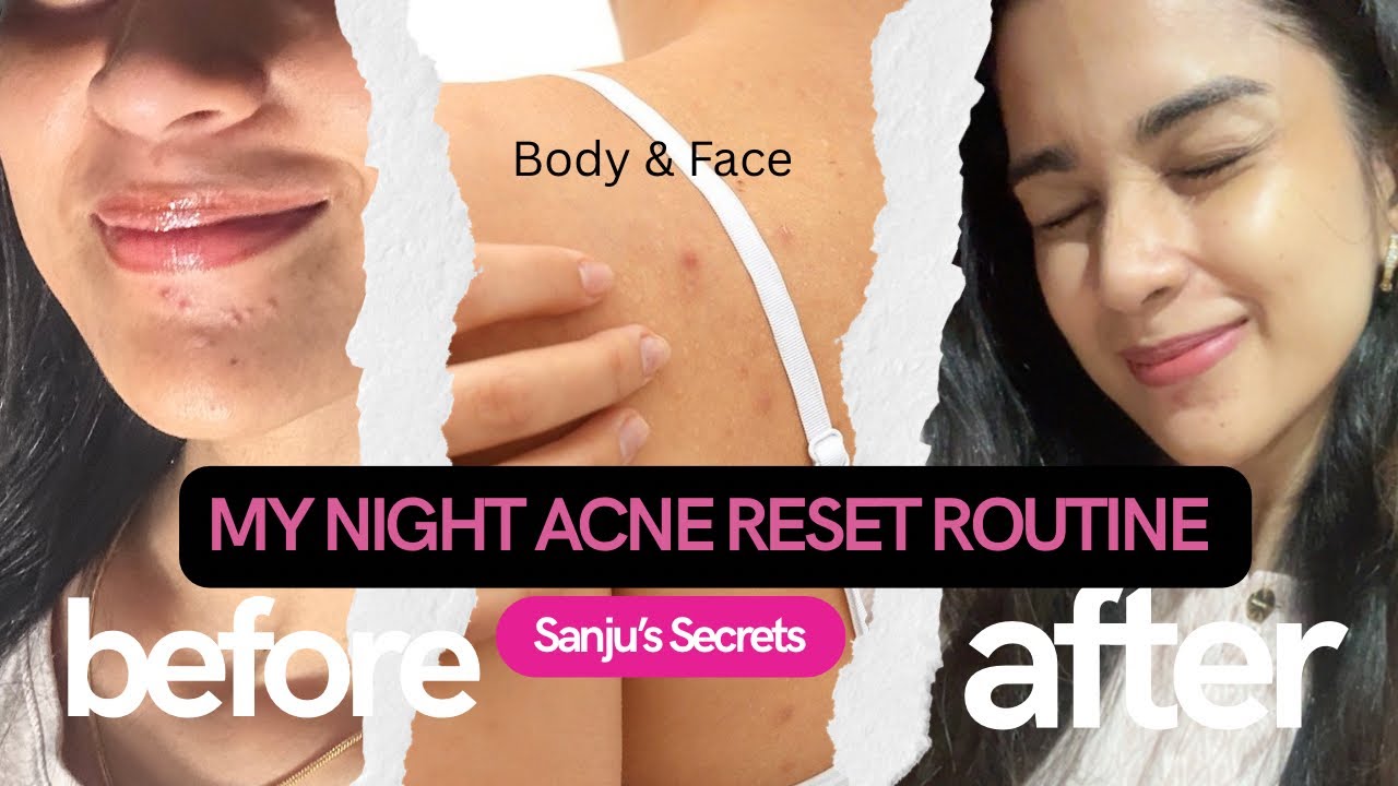 Post-Acne Night Routine That Cleared My Skin | Products + Affirmations
