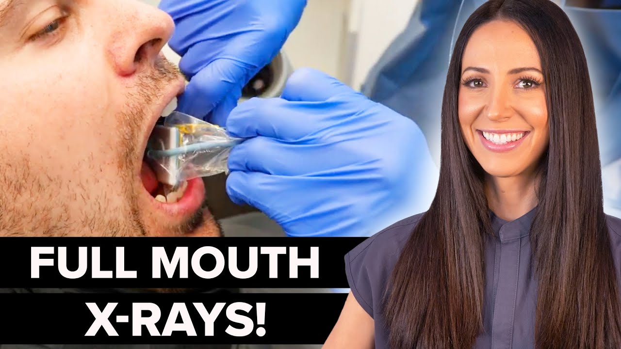 Dental Hygienist Explains Full Mouth Dental X-Ray (FMX)