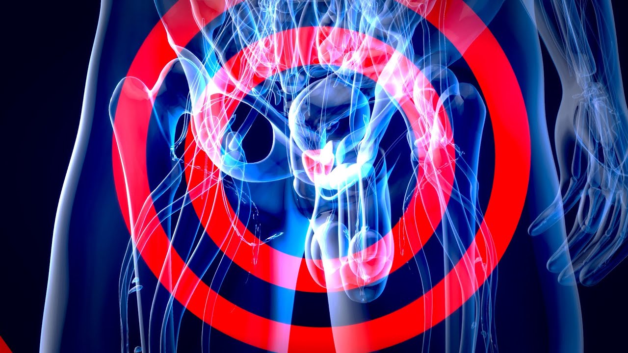 IPERTROFIA PROSTATICA BENIGNA: I FARMACI E LE NUOVE TECNICHE CHIRURGICHE , DAL LASER ALLA ROBOTICA