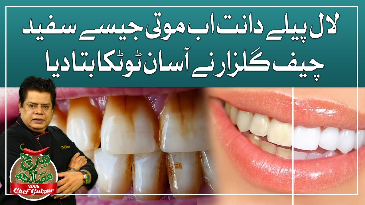 Treatment For White Teeth | Remedy for White Teeth | Chef Gulzar's Remedy | GTV Food