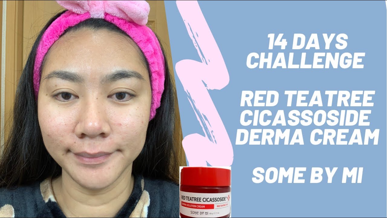 14 DAYS CHALLENGE SOME BY MI - RED TEATREE CICASSOSIDE DERMA SOLUTION CREAM