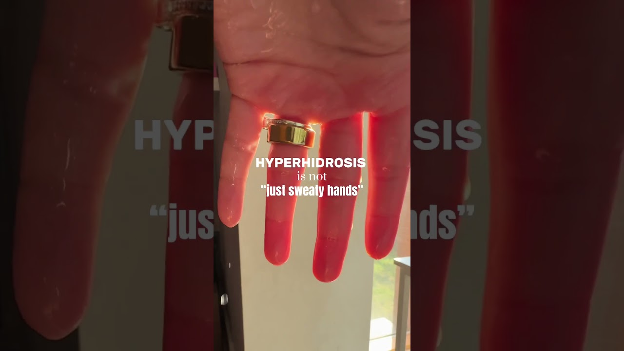 Hyperhidrosis is NOT &ldquo;just sweaty hands&rdquo; To learn more connect with us on Instagram! 💙