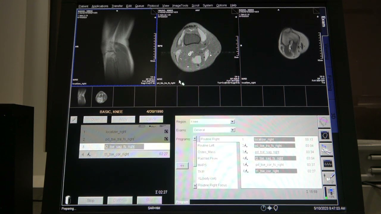 Basic Knee MRI