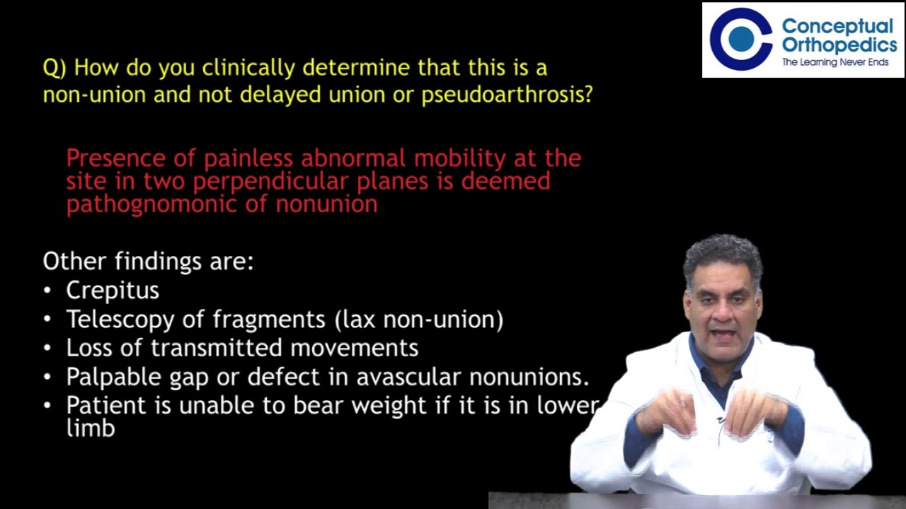 Theory - Nonunion by Dr Apurv Mehra