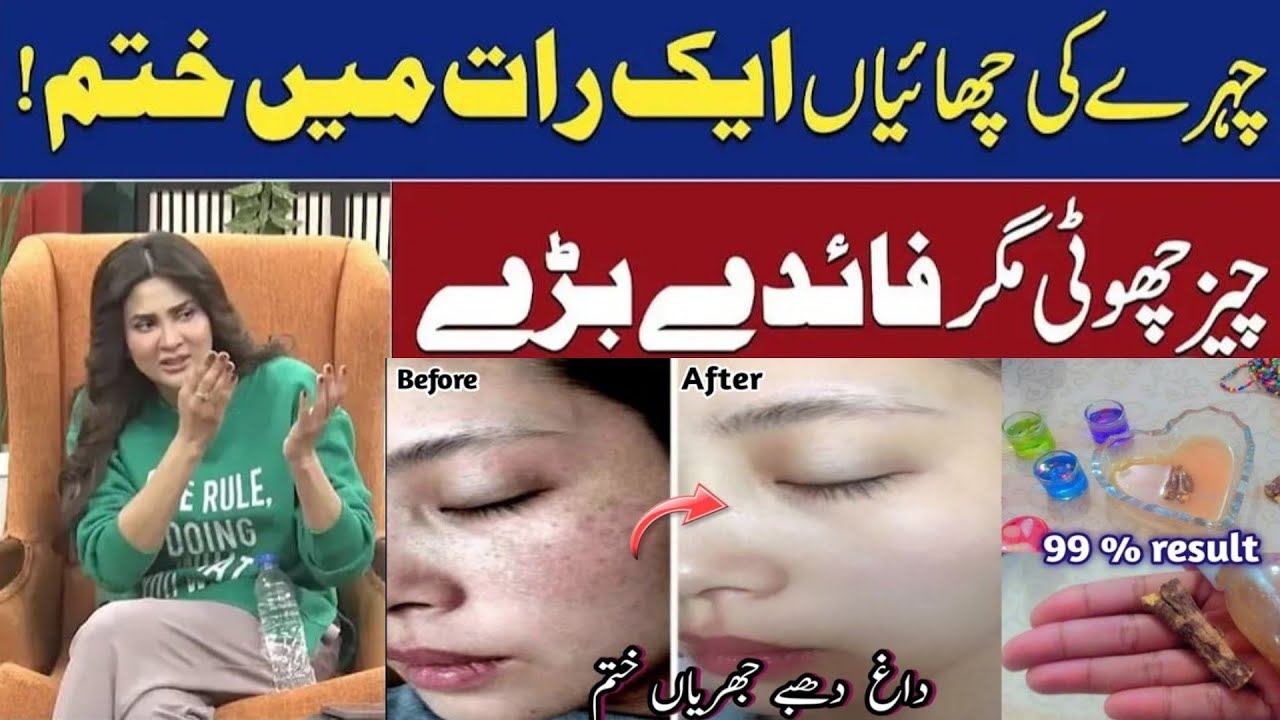 Natural Secret For Freckles & Dark Spots || Gharelu Totkay se Rang Gora Hamesha Kay Liye