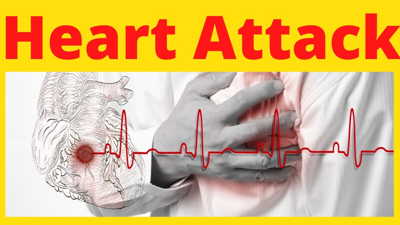Heart Attack | SSC Biology | Cardiovascular Disease  | English Version | Fahad's Tutorial