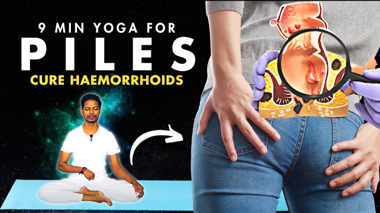 Piles Exercise at Home | Yoga for Piles | Yoga for Piles and Fissures