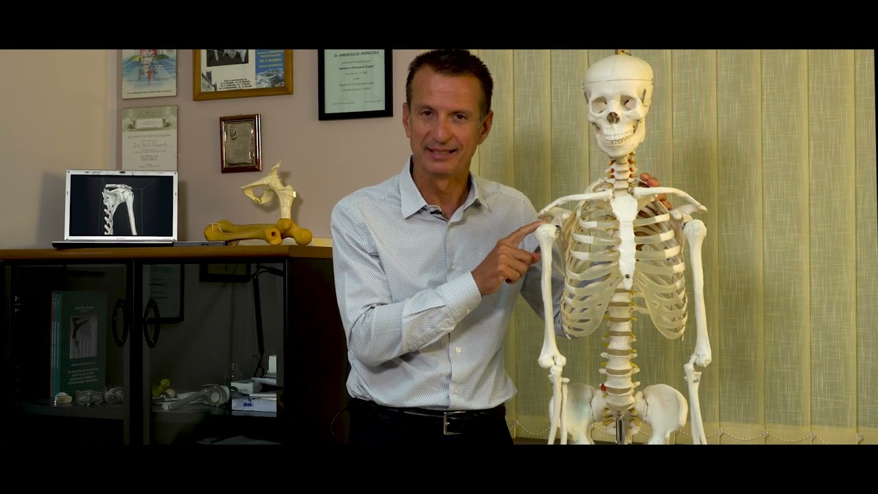 Protesi inversa di spalla - Dr. Piernicola Dimopoulos