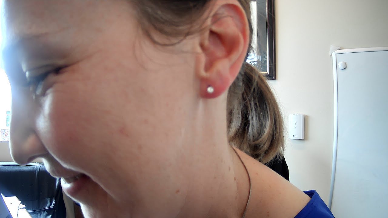 Medical Ear Piercing!