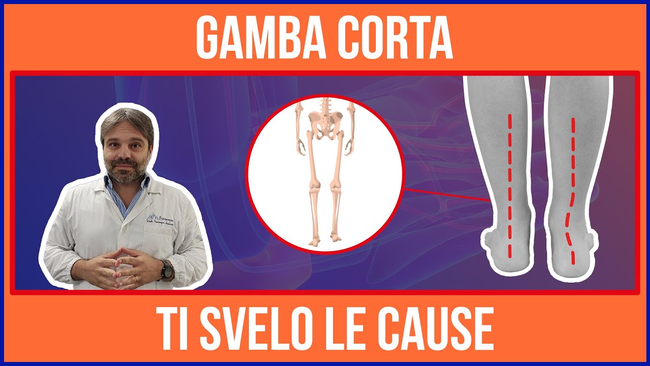 GAMBA CORTA e BACINO STORTO - TI Svelo le CAUSE 💥