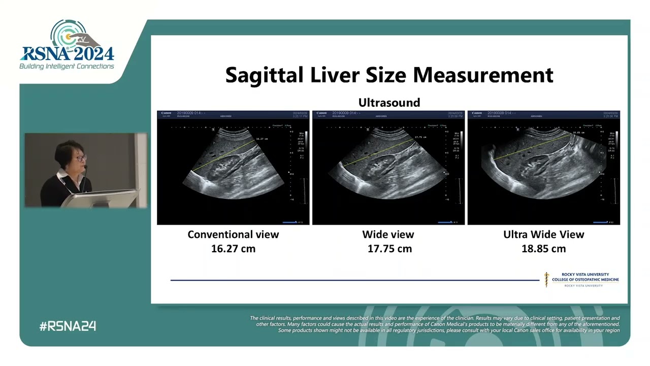 RSNA 2024 Presentation - Jing Gao, MD