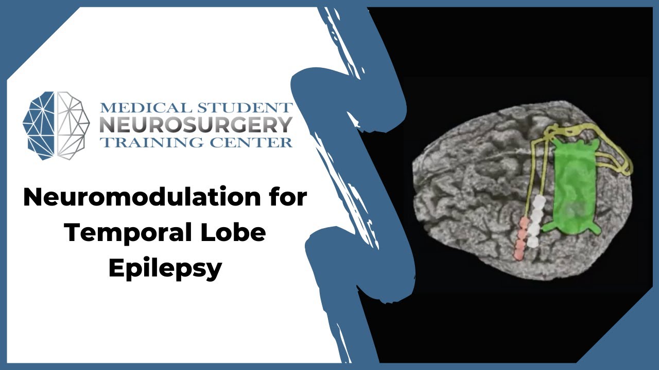 Neuromodulation for Temporal Lobe Epilepsy