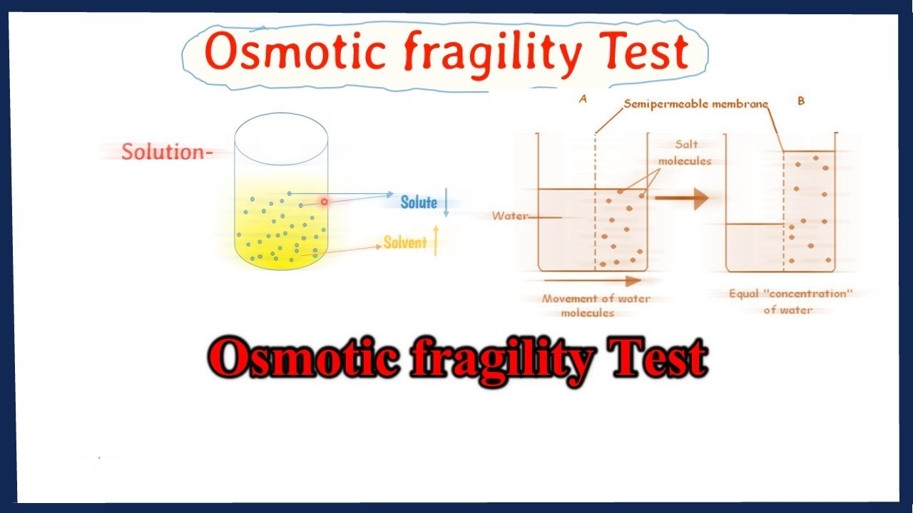 osmotic fragility test || osmotic fragility curve interpretation || full explained
