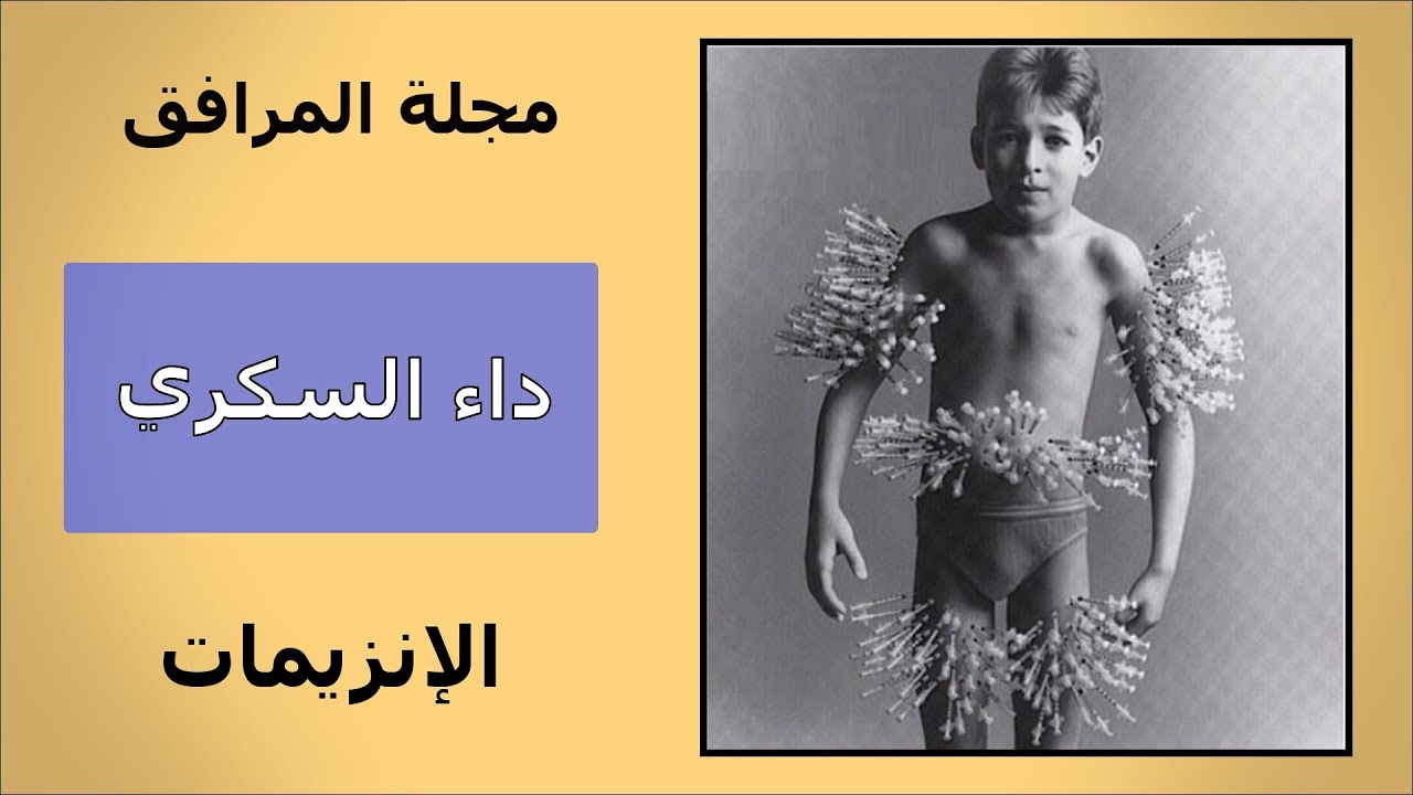 - التمرين 3 في الإنزيمات [ يتحدث عن مرض السكري ] .