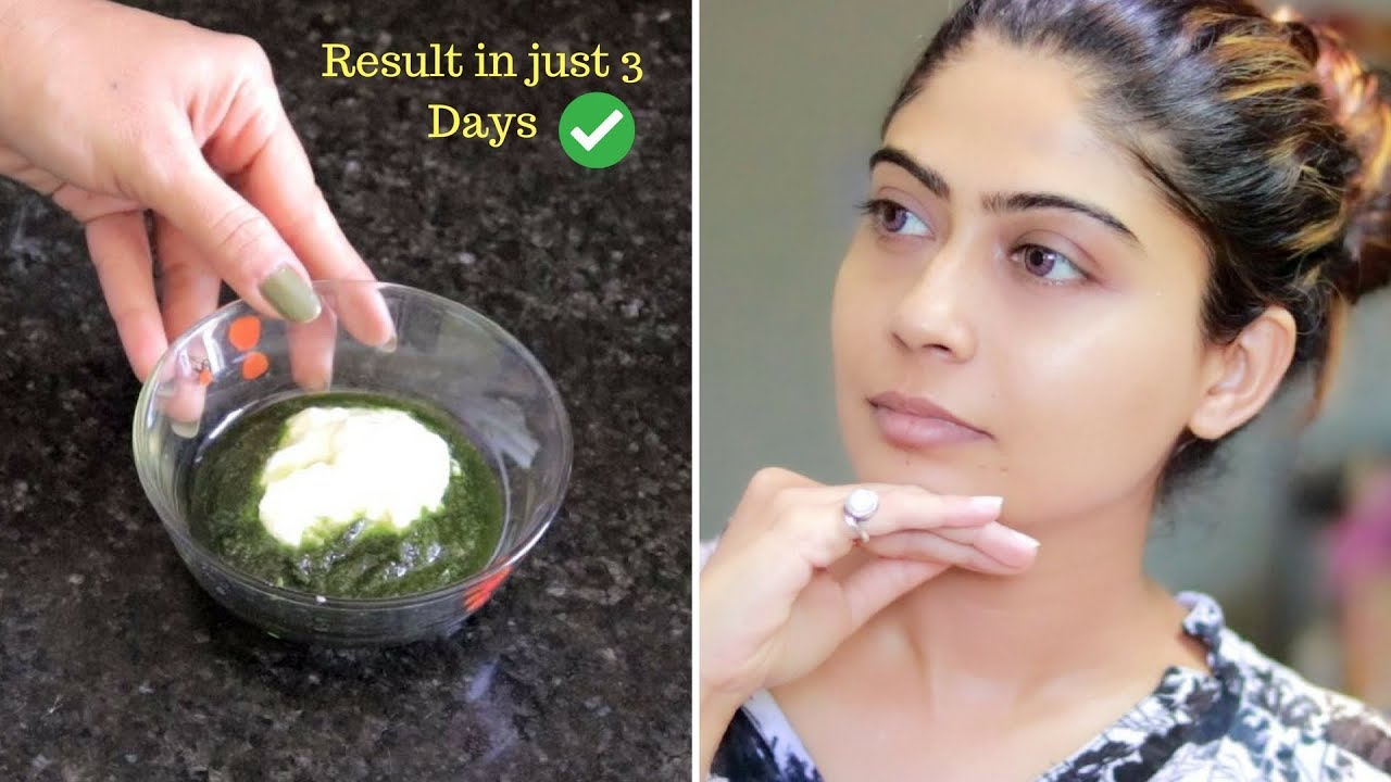 OMG! This Face pack Remove Your Dark Spots, Brown Spots, Pigmentation & Pimples in just 3 Days