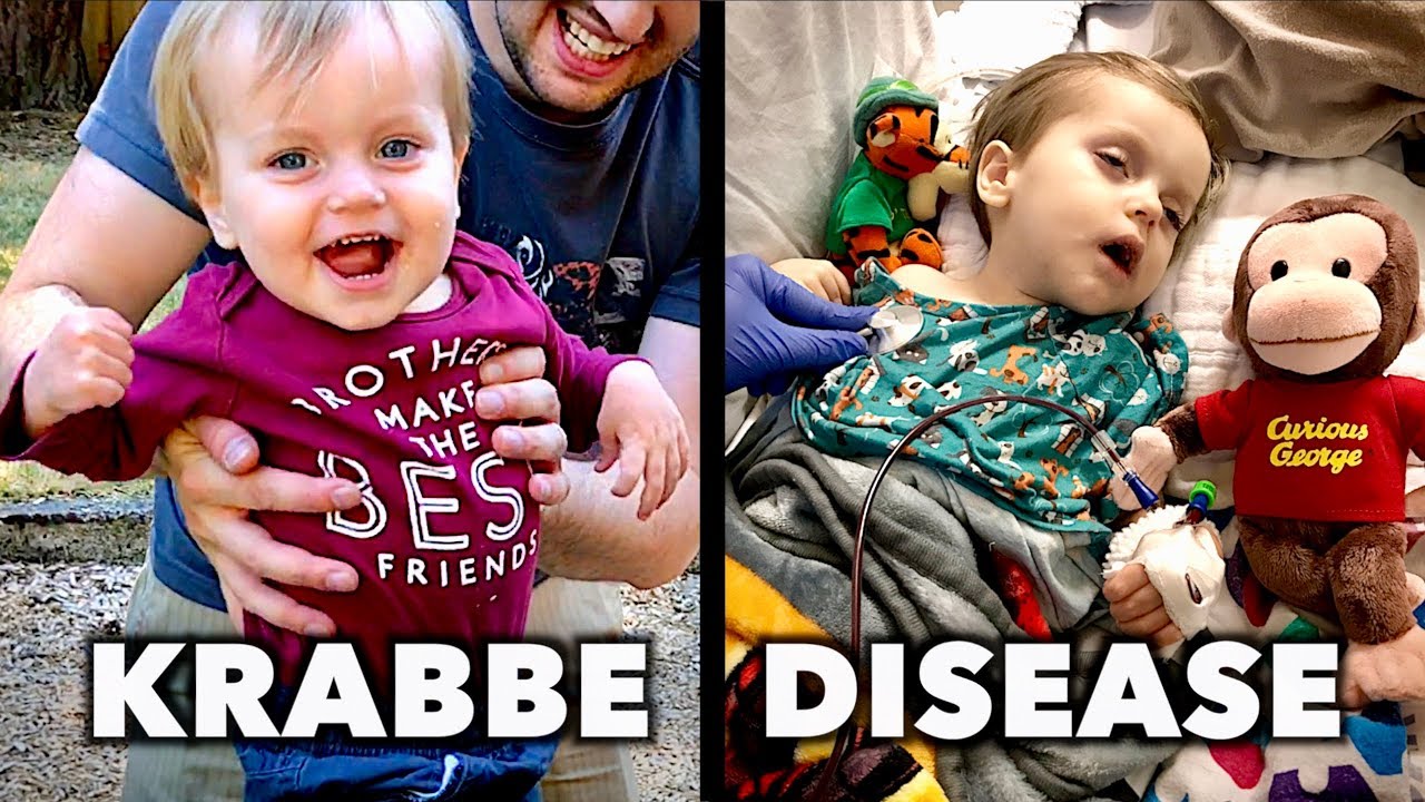 KRABBE DISEASE: Emmett's Story (He Doesn't Have Much Time) |  Dr. Paul