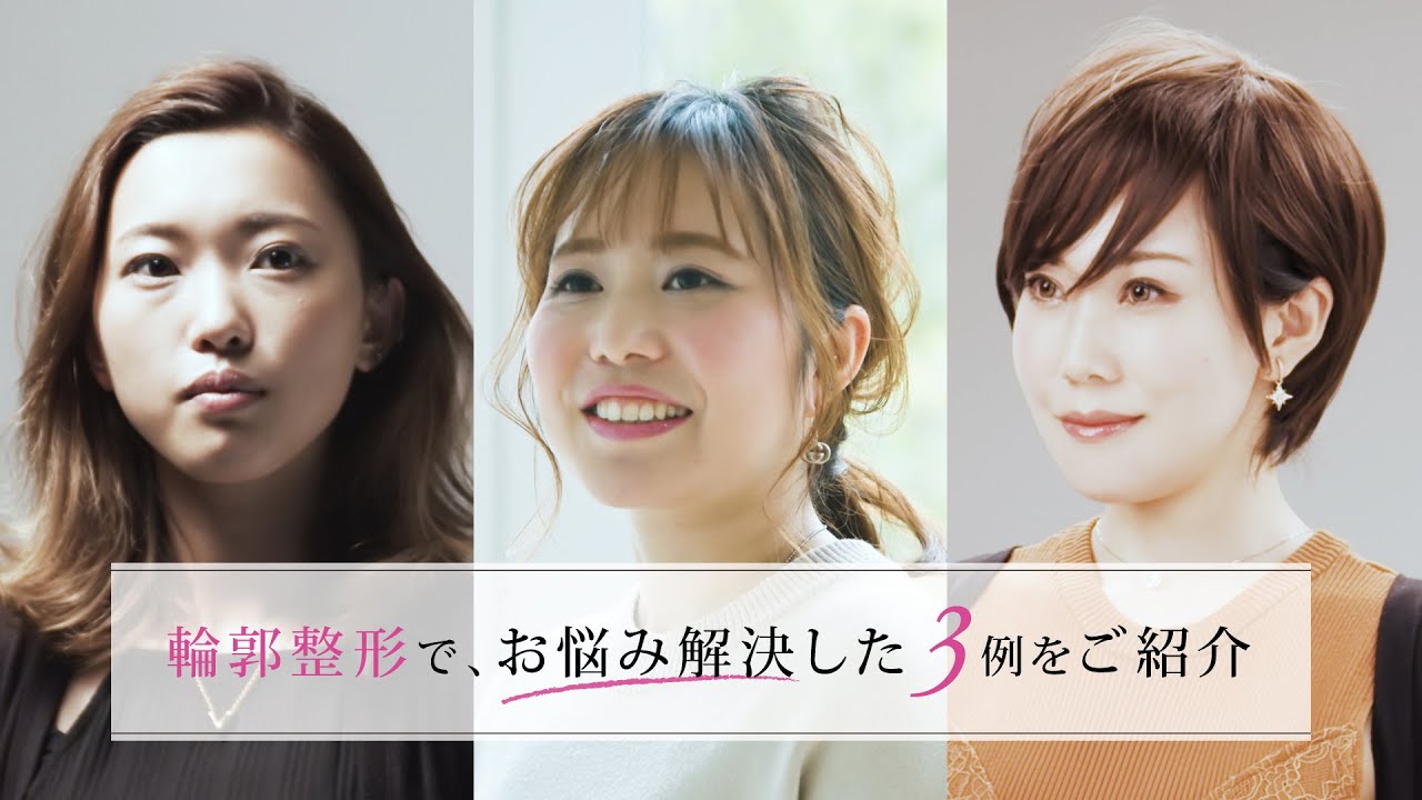 輪郭形成でお悩み解決した患者様をご紹介 ～ カトレア歯科・美容クリニック